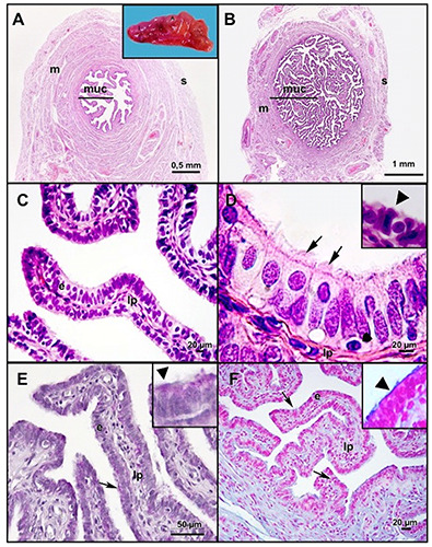 Molecules involved in the sperm interaction in the human uterine tube ...