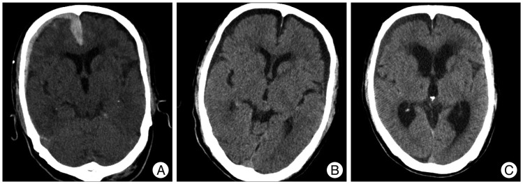 Fig. 5