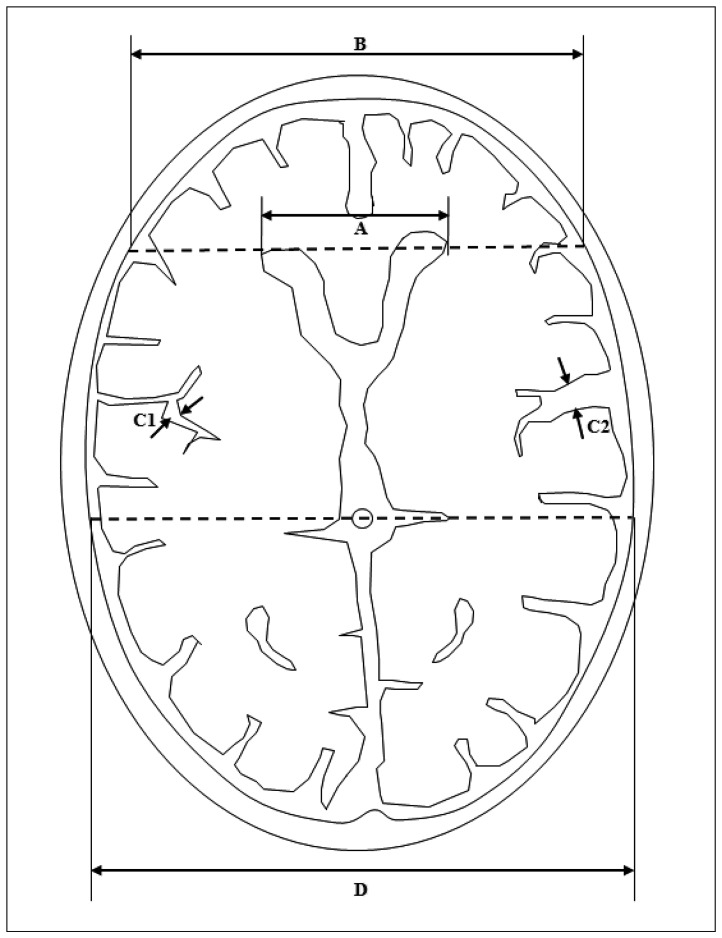 Fig. 2