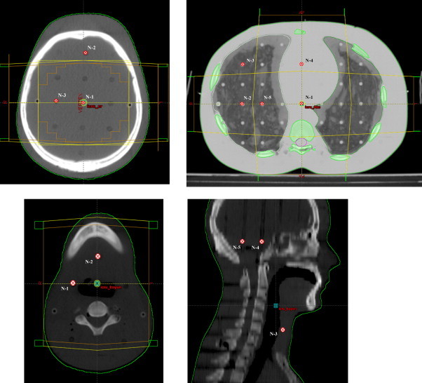 Fig. 2