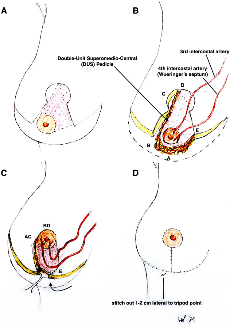 Fig. 4