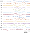 Figure 11.