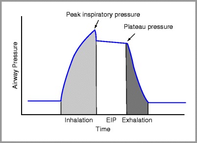 FIGURE 23-4 