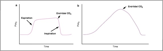 FIGURE 23-7 