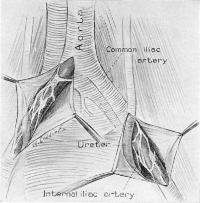 FIG. 11.