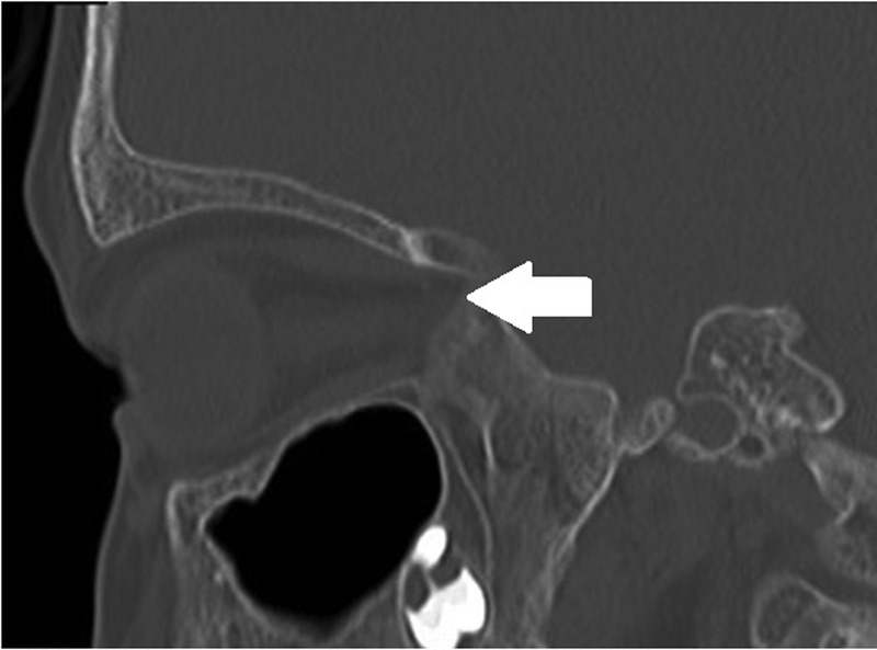 Figure 2