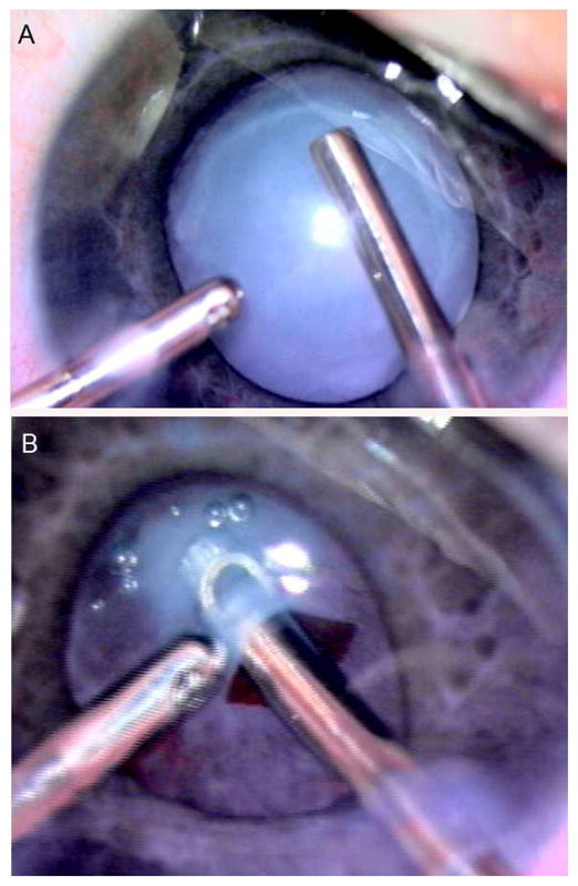 FIG 3