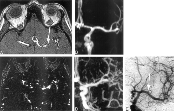 Fig 2.