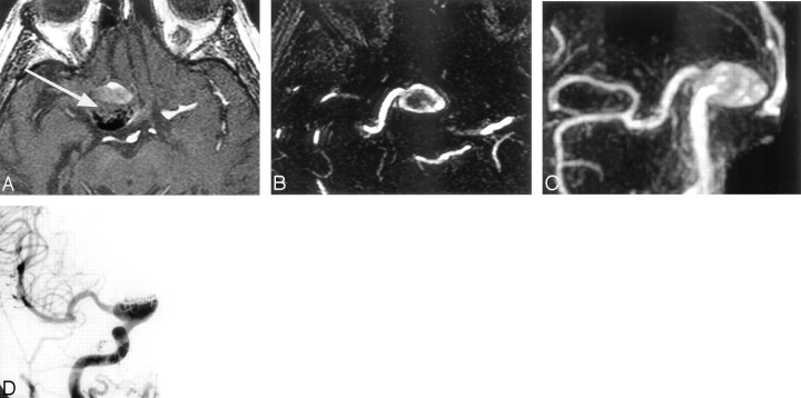 Fig 3.