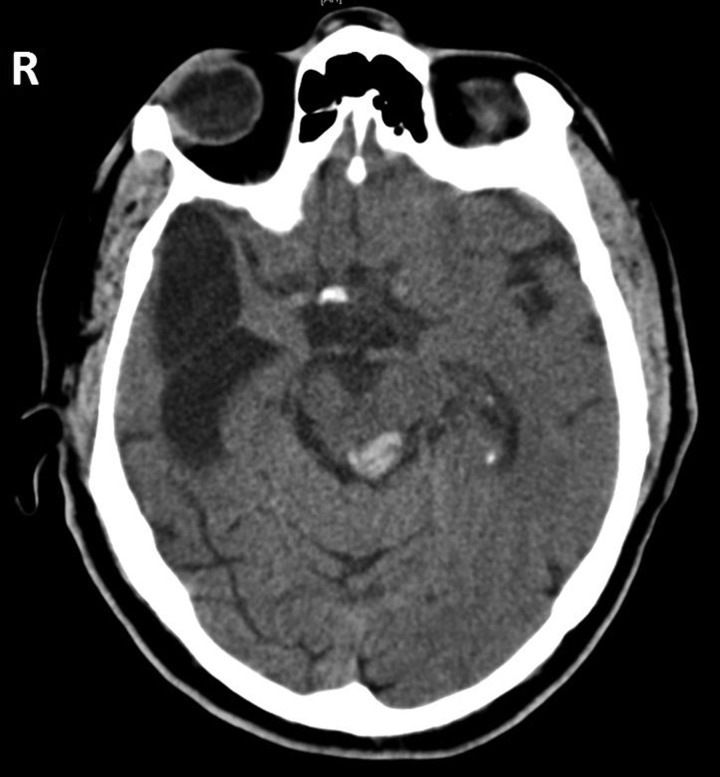 Figure 2