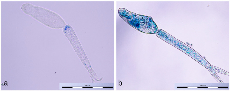 Figure 11