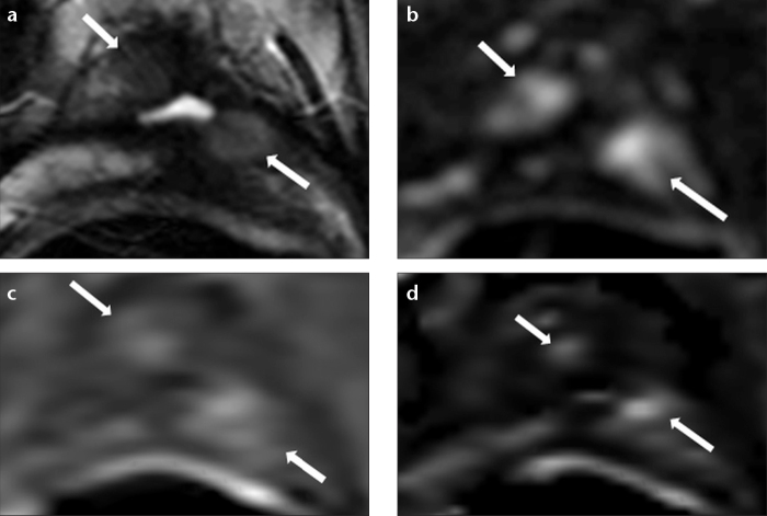 Figure 1. a–d.