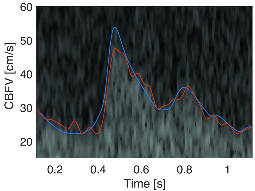 FIGURE 11.