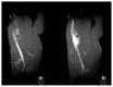 Figure 11 a, b