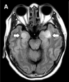 Figure 2a: