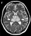 Figure 2f:
