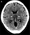 Figure 1a:
