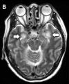 Figure 2b: