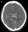 Figure 1b: