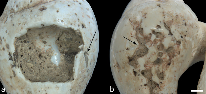 Fig. 12