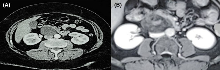 FIGURE 1