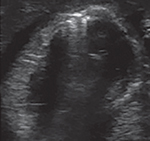 graphic file with name nihms-1935670-t0022.jpg