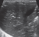 graphic file with name nihms-1935670-t0024.jpg