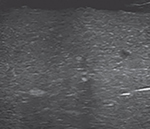 graphic file with name nihms-1935670-t0023.jpg