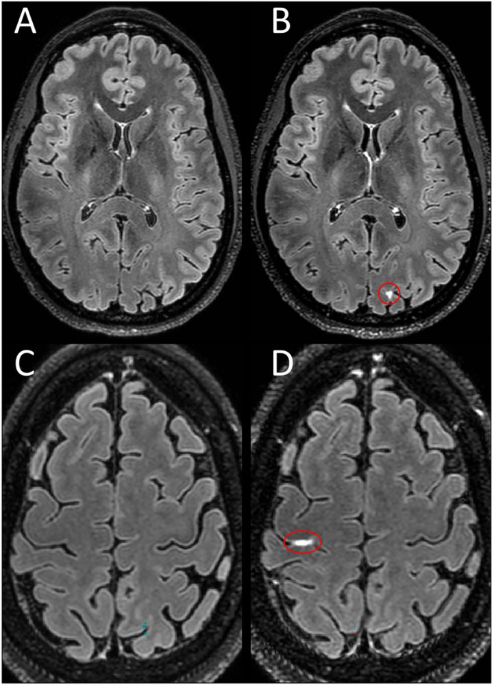 Fig 4