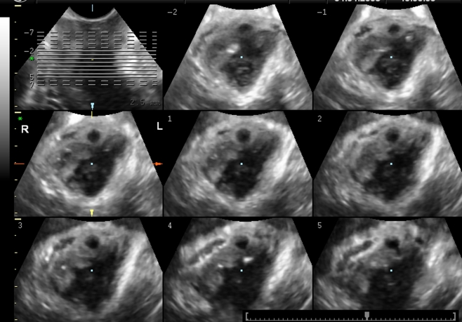 Fig. 3