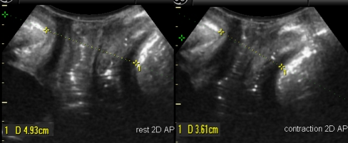 Fig. 1