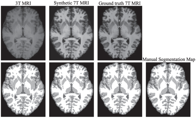 Fig. 18.