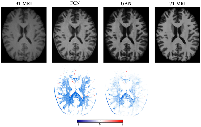 Fig. 13.