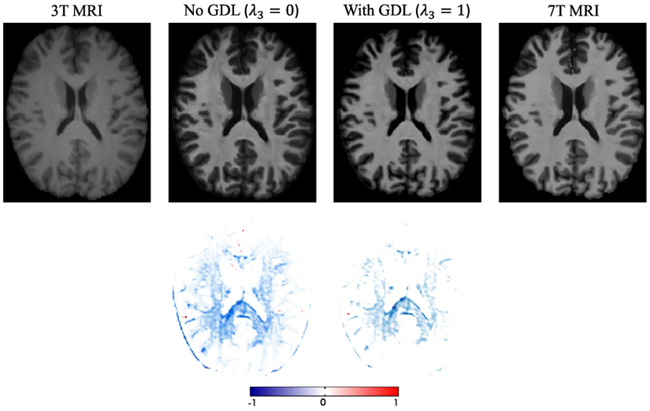 Fig. 14.