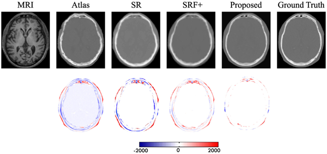 Fig. 11.