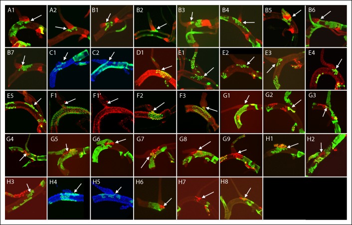 Figure 4—figure supplement 1.