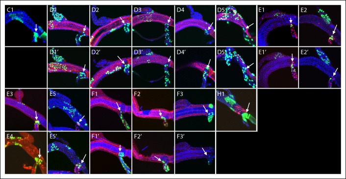 Figure 4—figure supplement 5.