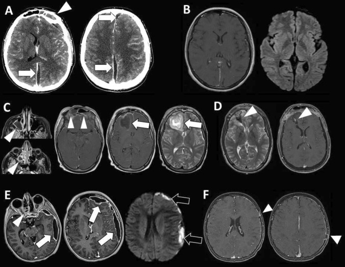 Fig. 2