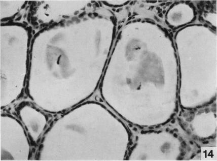 Fig. 14