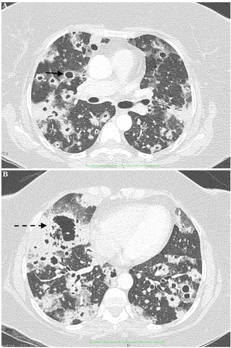 Fig 2