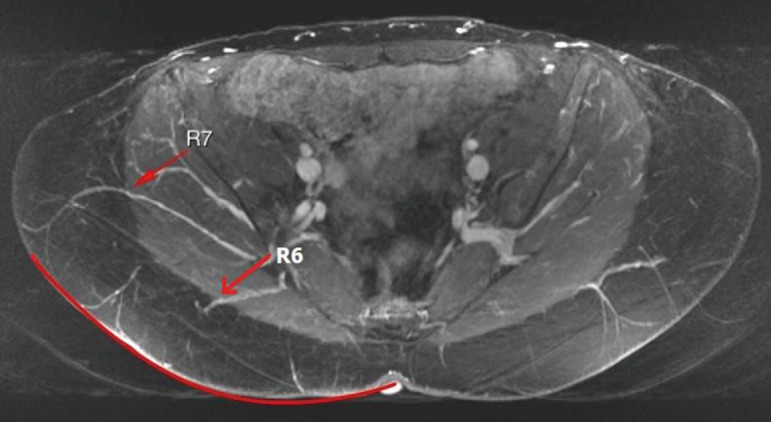 Figure 16