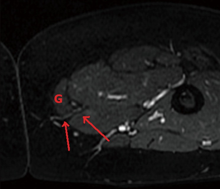 Figure 18