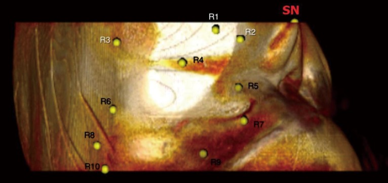 Figure 23