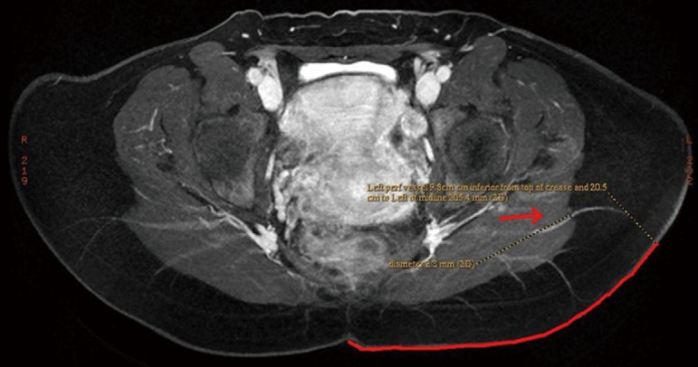 Figure 14