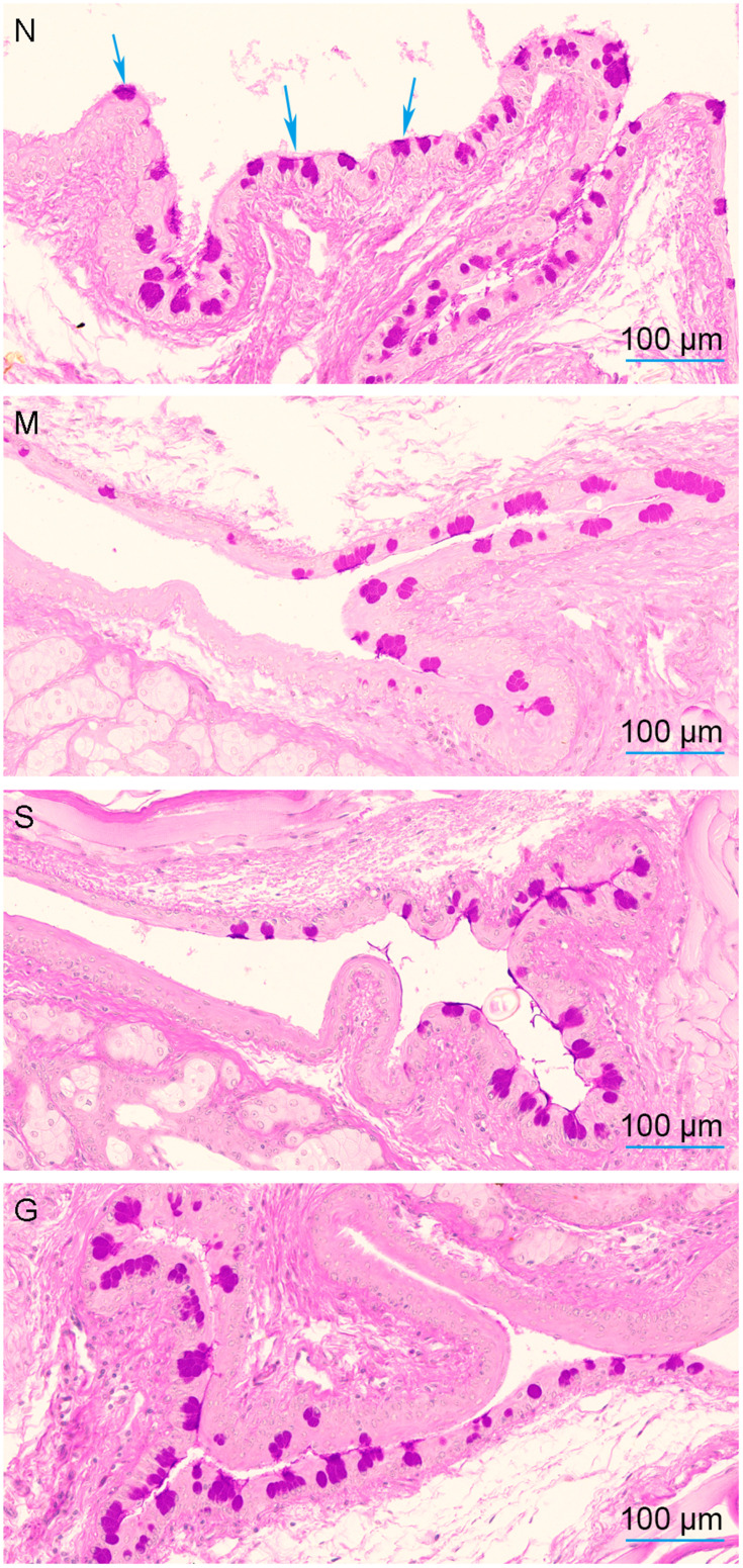 Figure 17