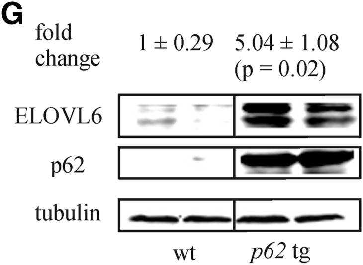 Fig. 1G