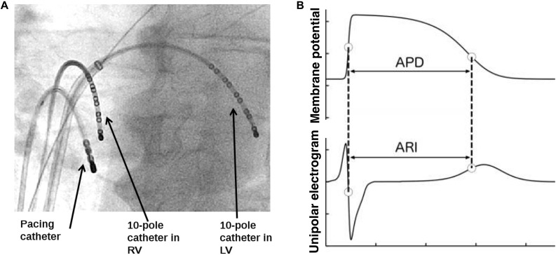 FIGURE 1