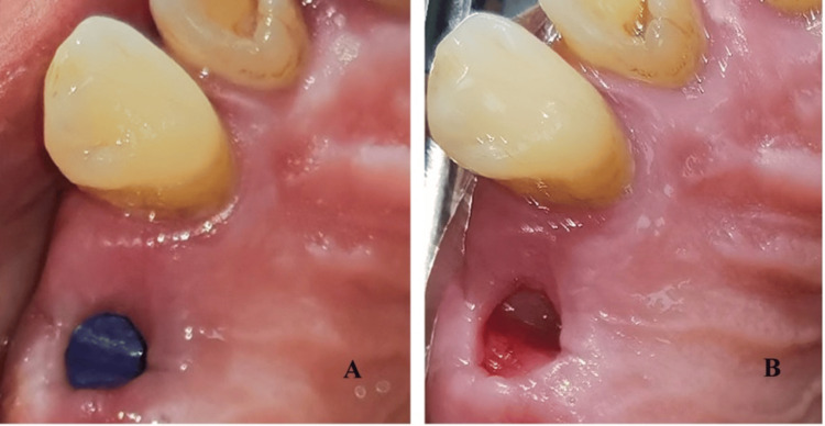 Figure 9