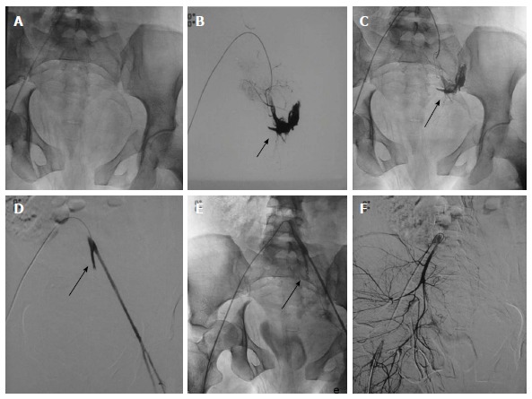 Figure 14