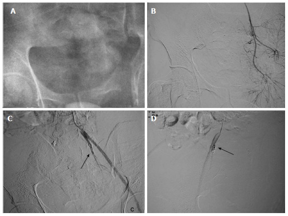 Figure 15